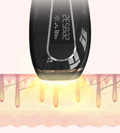 Home Laser Hair Removal Device for Full Body Care